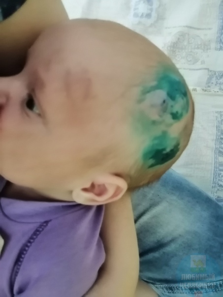 В челябинской больнице мать издевалась над двухмесячным ребёнком В Челябинской областной детской